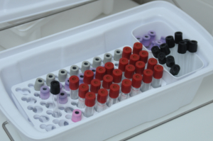 Лабораторные диагностические исследования доступны ежедневно в клинике "ЮниМед"